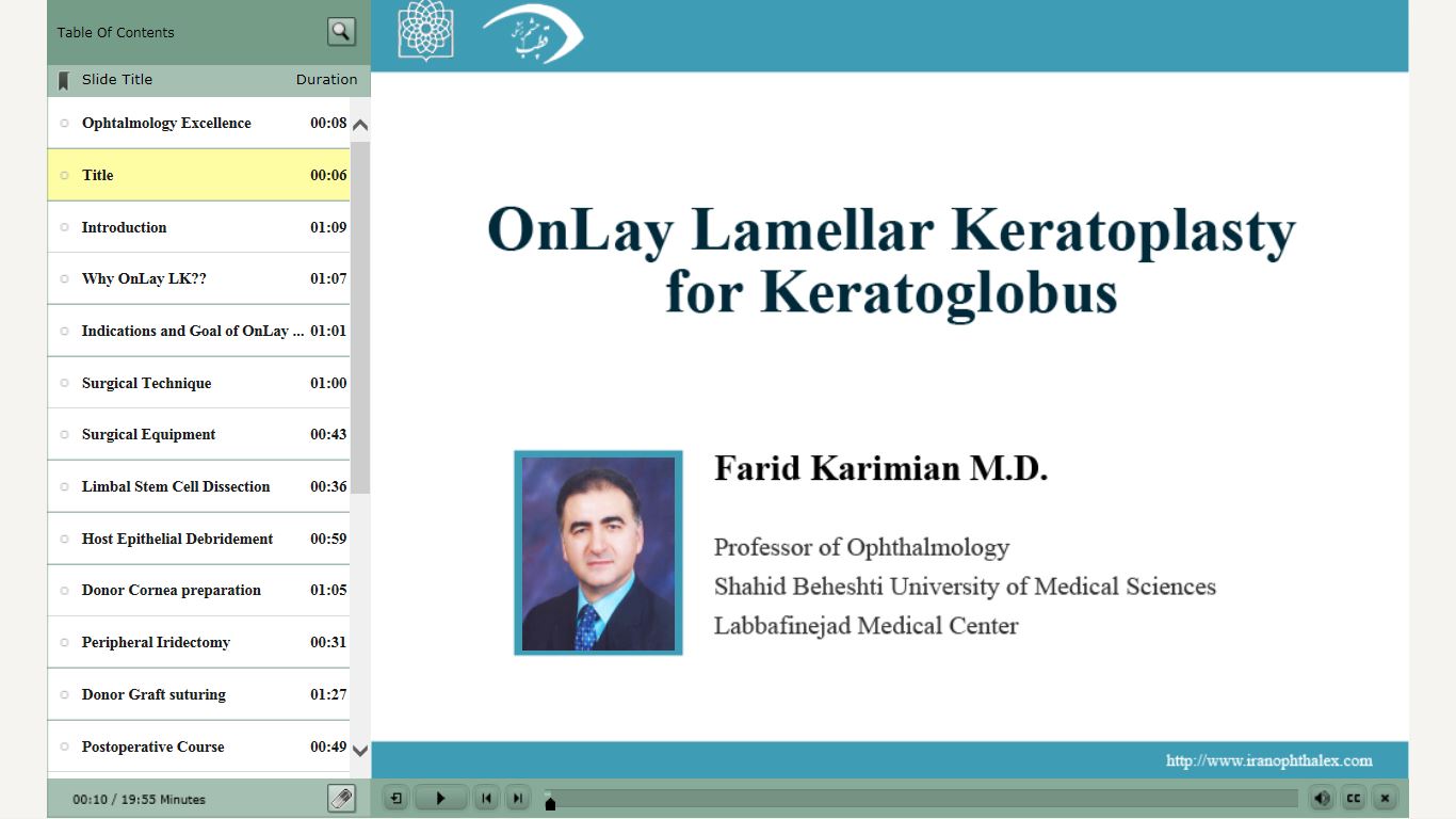 OnLay Lamellar Keratoplasty for Keratoglobus